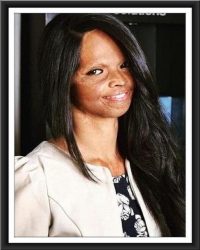 LAXMI-AGARWAL-200x250